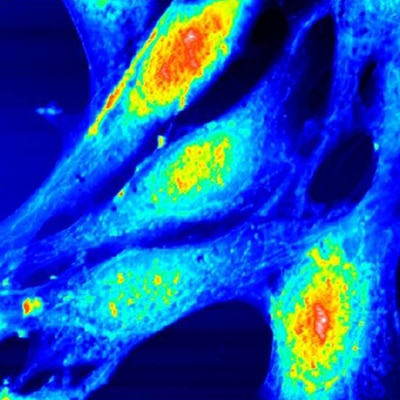Fibroblastes embryonnaires, mode oscillant, 80 µm