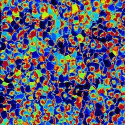 Stainless steel, resiscope mode, 1µm