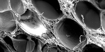 Microscopie Electronique à Balayage (MEB) - Institut de physique